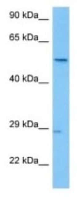 BTBD2 Rabbit anti-Human, Polyclonal, Novus Biologicals 100 &mu;g | Buy Online | Novus Biologicals | Fisher Scientific